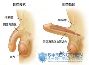 ���������ϰ�������