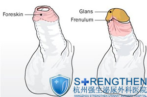 ��Ƥ����������й