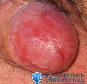 ��ͷ���ֺ�����ô����?