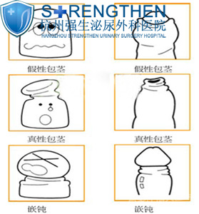 ��ηֱ��Ƥ�����Ͱ�����