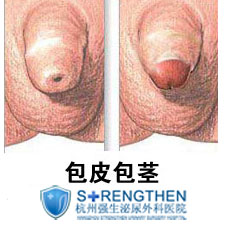 ���԰�Ƥ��������Ҫ��Ҫ����