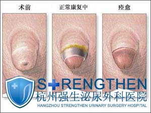 ��Ƥ��������й�Ĺ�ϵ