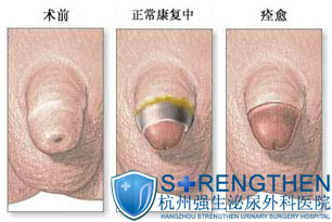 ��Ƥ������ͼƬ