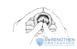 ��Ƥˮ��ͼƬ